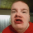 PegPelvisPete